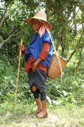 An elderly Kunge woman with bound calves